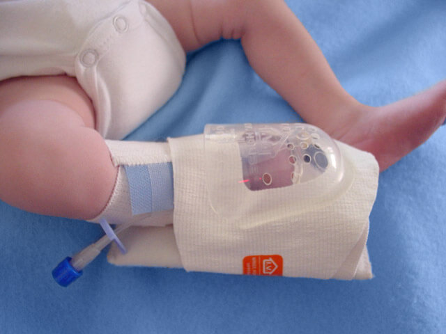 Parent Trauma: When Your Child Is in the NICU